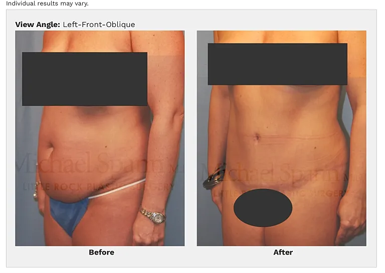 Before and after body transformation images.