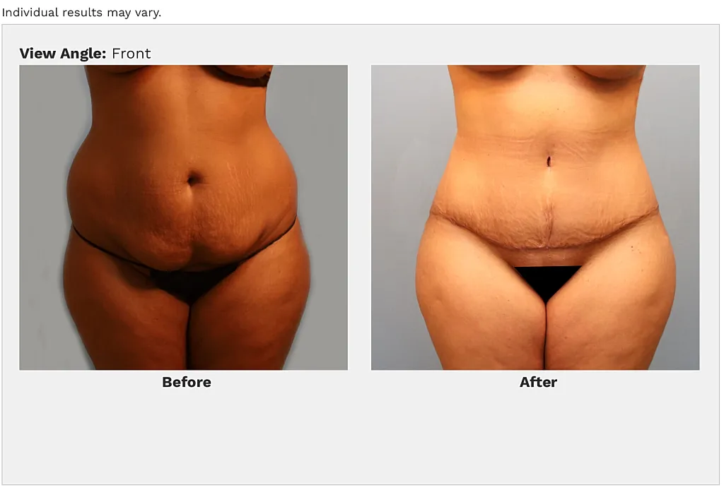 Before and after body transformation comparison.